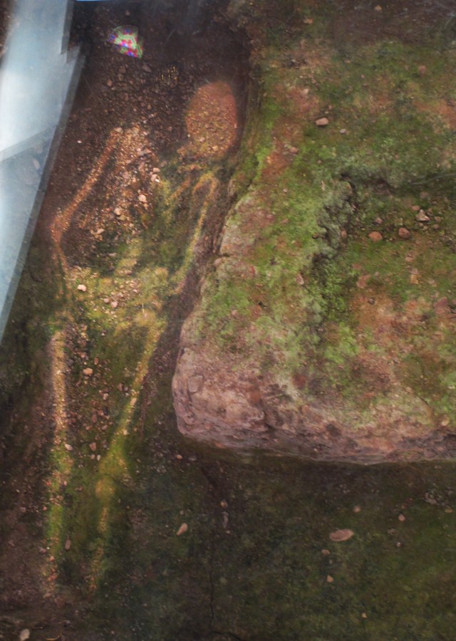 projection showing Richard's bones